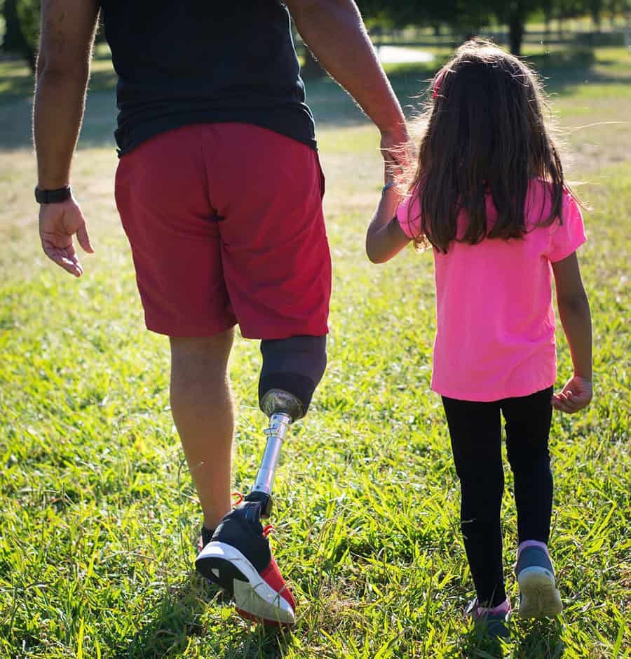 father with prosthetic leg walking with daughter