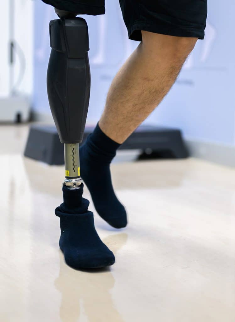 man standing on a prosthetic leg
